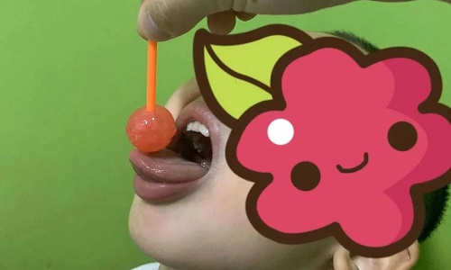 利用棒棒糖作为兴趣物，诱导孩子完成舌上翘等口肌练习