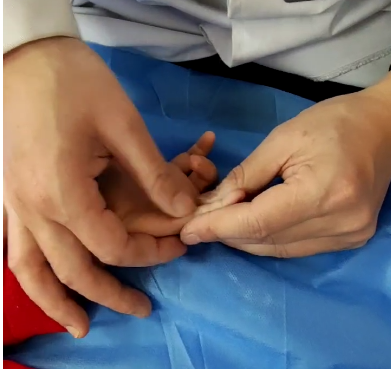 中医老师正在给孩子做手部的推拿，调理脾胃功能